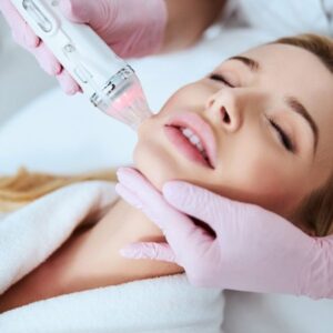 Microneedle Radiofrequency Treatment