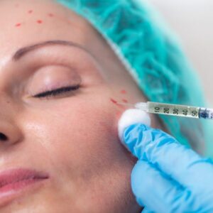 PRP Treatment London