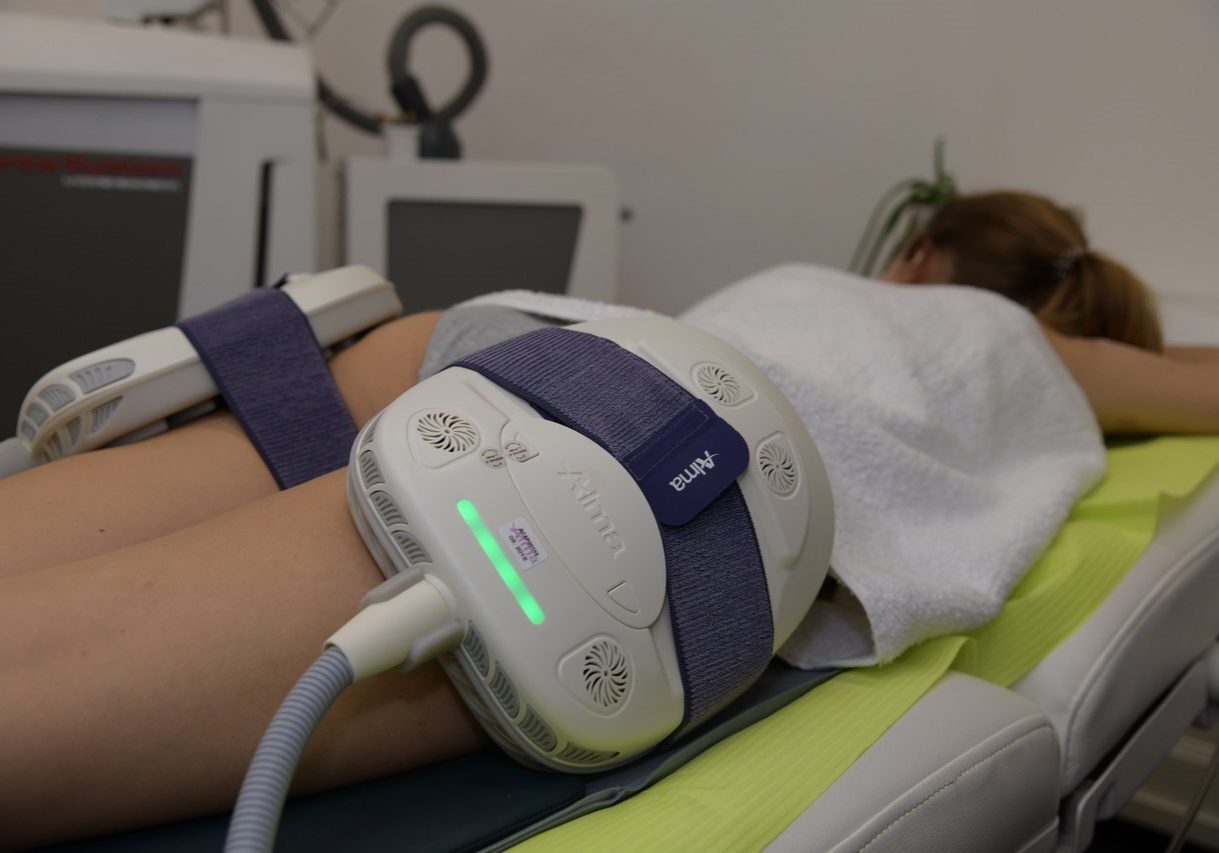 Alma Accent Prime Body Sculpting & Contouring In London Alma Accent Prime Body Sculpting & Contouring In London